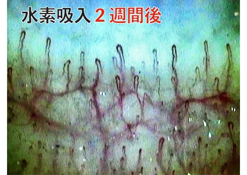 水素吸引